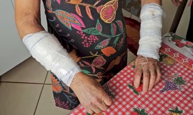 Idosa é atacada por dois pitbulls em Muriaé