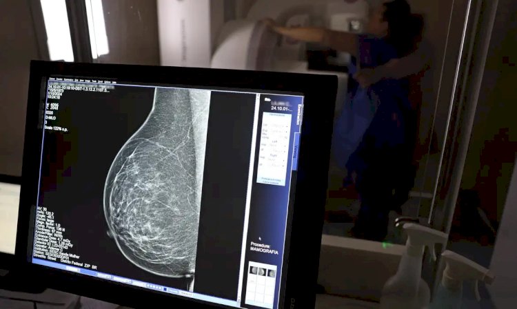 Pesquisa aponta que 77 mil mulheres aguardam mamografia pelo SUS